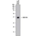 HSD17B1 Monoclonal Antibody (860020)