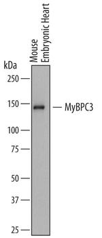MYBPC3 Monoclonal Antibody (751631)