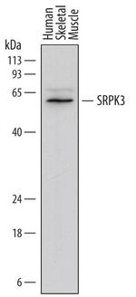 SRPK3 Antibody in Western Blot (WB)