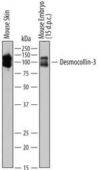Desmocollin 3 Monoclonal Antibody (765129)