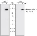 Phospho-CD22 (Tyr822) Antibody in Western Blot (WB)