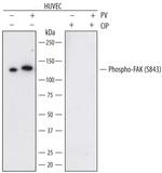 Phospho-FAK (Ser843) Antibody in Western Blot (WB)