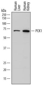 PCK1 Monoclonal Antibody (789114)