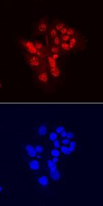 CHD7 Monoclonal Antibody (772503)