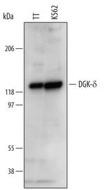 DGKD Monoclonal Antibody (625423)