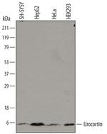 Urocortin Monoclonal Antibody (749606)
