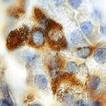 CHST3 Monoclonal Antibody (799011)