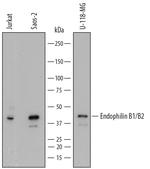 Endophilin B1/B2 Monoclonal Antibody (807009)