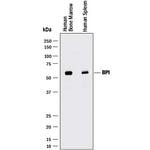 BPI Monoclonal Antibody (971526)