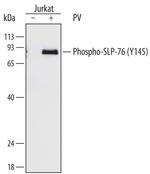 Phospho-SLP76 (Tyr145) Monoclonal Antibody (776503)