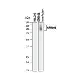 GPR101 Monoclonal Antibody (909603)