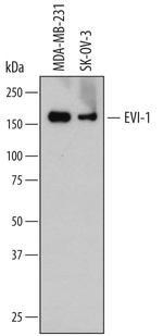 EVI1 Monoclonal Antibody (702319)