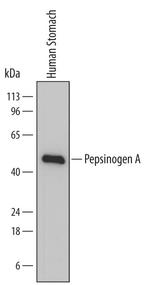 Pepsinogen I Monoclonal Antibody (762015)