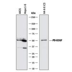 Thymidine Phosphorylase Monoclonal Antibody (826722)