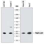 TMP21 Antibody in Western Blot (WB)