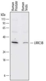 LRP15 Antibody in Western Blot (WB)