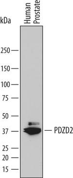 PDZD2 Antibody in Western Blot (WB)