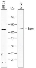 FRMPD4 Monoclonal Antibody (809408)