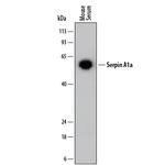alpha-1 Antitrypsin Antibody in Western Blot (WB)