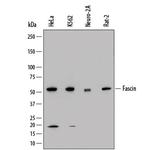 Fascin Monoclonal Antibody (833223)