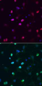 SOX6 Monoclonal Antibody (667136)