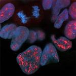 Phospho-BAD (Ser99) Antibody in Immunocytochemistry (ICC/IF)