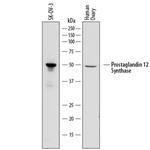 PTGIS Monoclonal Antibody (852307)