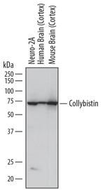 ARHGEF9 Monoclonal Antibody (809309)