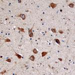 DOC2A Monoclonal Antibody (842213)