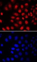 MSX2 Monoclonal Antibody (786607)