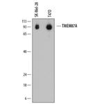 TMEM87A Monoclonal Antibody (772807)
