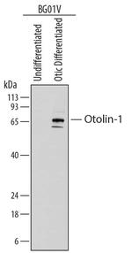 OTOL1 Monoclonal Antibody (839418)