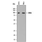 DAB2 Antibody in Western Blot (WB)