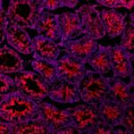 PTCH2 Monoclonal Antibody (865619)