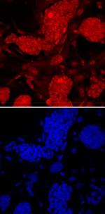 PRDM14 Monoclonal Antibody (856235)