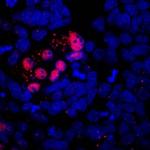 MIXL1 Monoclonal Antibody (868132)