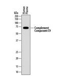 Complement C9 Monoclonal Antibody (887025)
