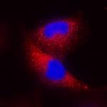 IFN beta Monoclonal Antibody (937912)