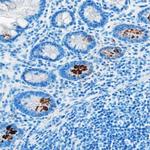 Acylated Ghrelin Monoclonal Antibody (891240)