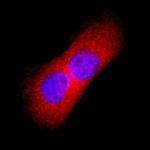 TK1 Monoclonal Antibody (1008515)