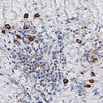 20S Immunoproteasome Monoclonal Antibody (894505)