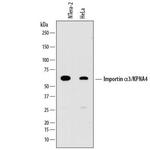 KPNA4 Monoclonal Antibody (843124)