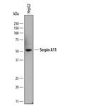 SERPINA11 Monoclonal Antibody (895842)