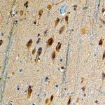 DRD5 Antibody in Immunohistochemistry (Paraffin) (IHC (P))