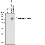 SLC11A1 Monoclonal Antibody (910825)