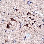 FAM20B Monoclonal Antibody (1018524)