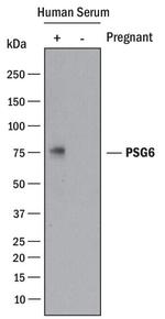 PSG6 Monoclonal Antibody (935926)
