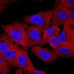 SH3KBP1 Antibody in Immunocytochemistry (ICC/IF)