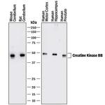 Creatine Kinase BB Monoclonal Antibody (969409)