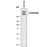 Desmoplakin Monoclonal Antibody (824038)